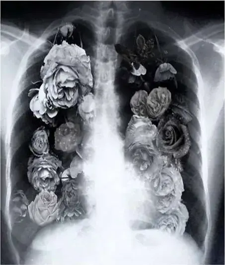 Radiografia de tórax em preto e branco com flores e rosas aplicadas sobre os pulmões